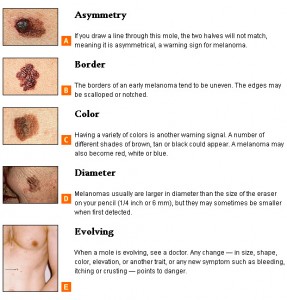 Skin cancer warning signs