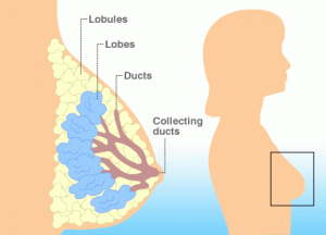 Breast Cancer Diagram